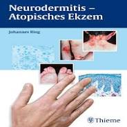 homöopathie ekzem