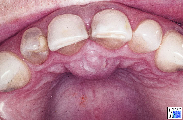 alternativmedizin bei zysten